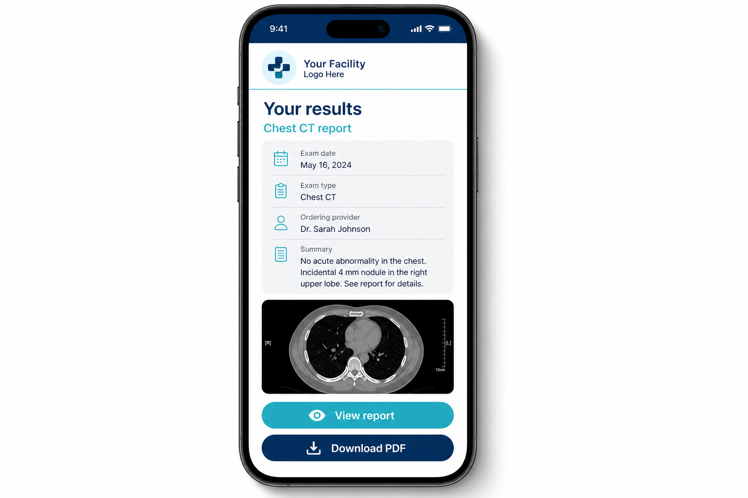 Patient portal showing results and imaging on a phone